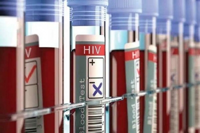 Cuba exhibe la más baja prevalencia de VIH/Sida en América Latina 