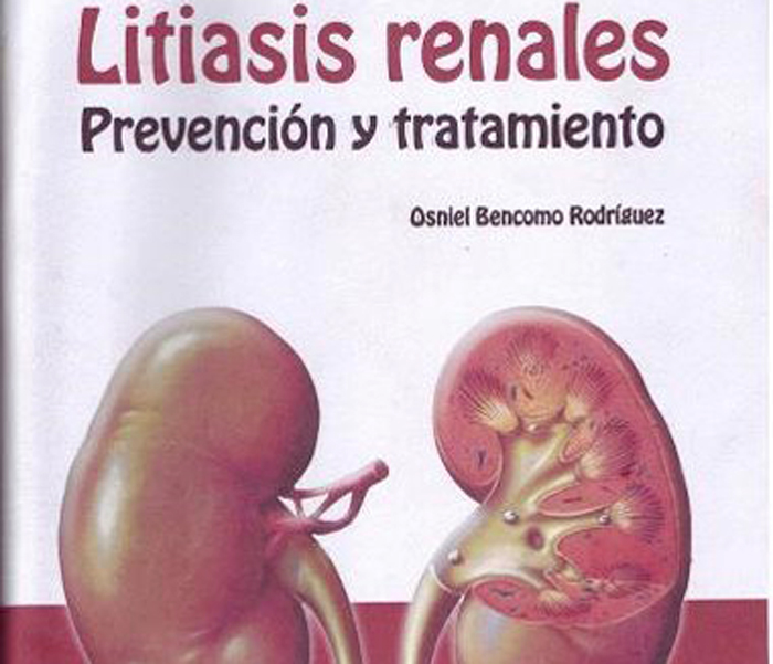 Litiasis Renales