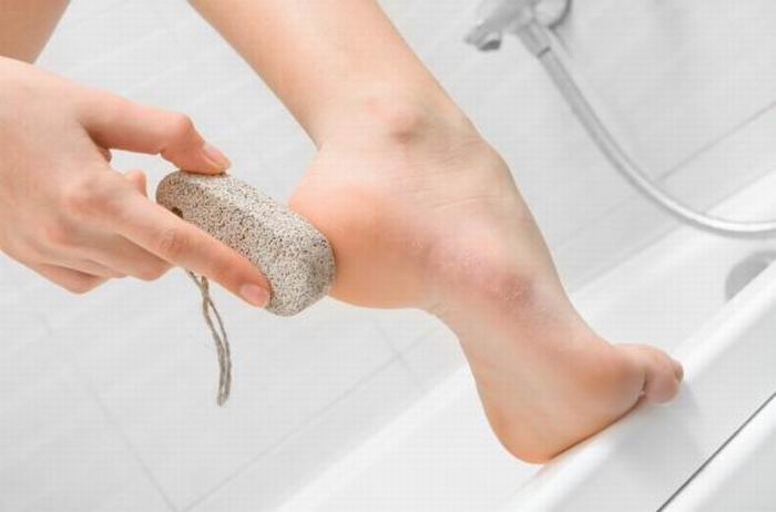 Aplicar piedra pómez en las callosidades