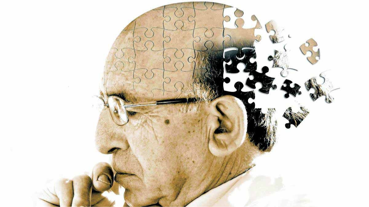 Demencia senil, Alzheimer
