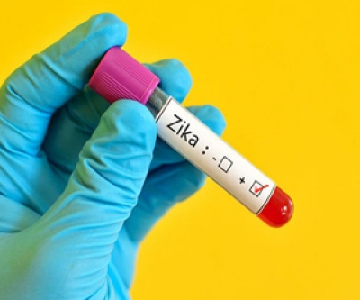 Vacuna contra el Zika Vacuna contra el Zika